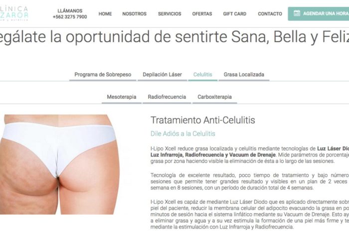 eliminación de ojeras en santiago
